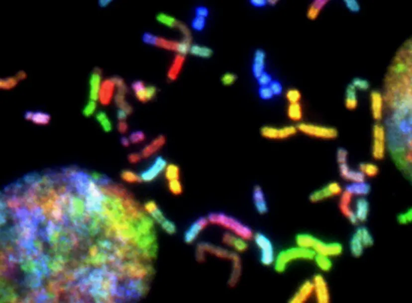 brain cancer chromosomes