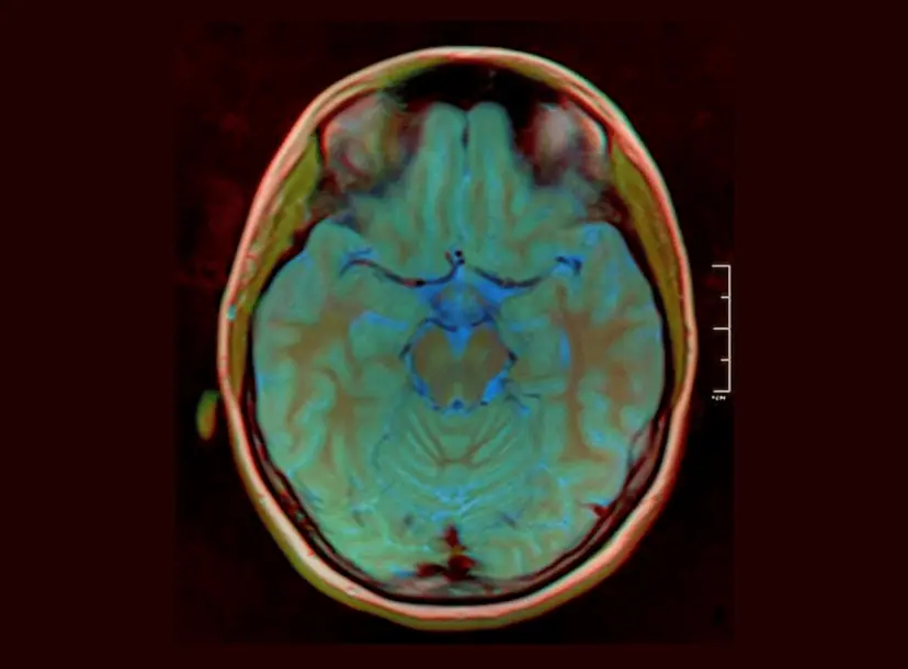 Color Brain MRI