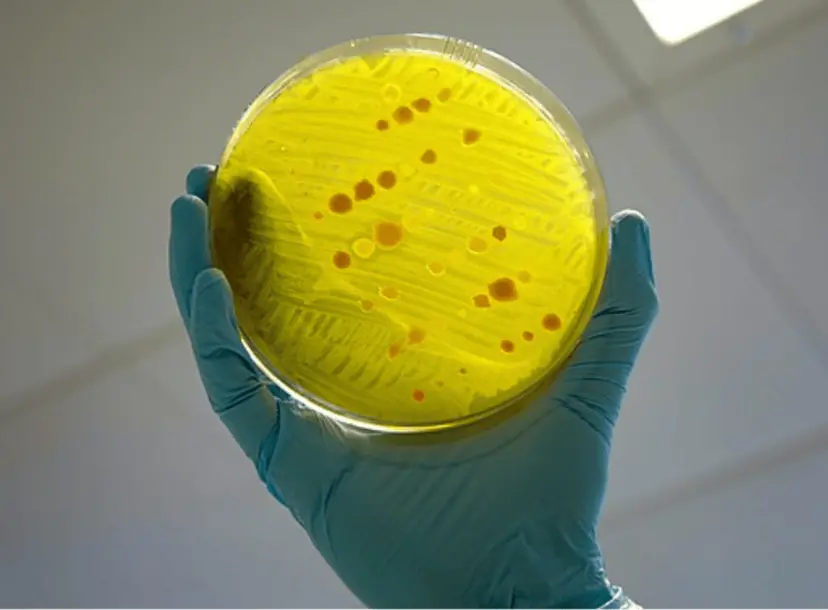 A variety of different bacteria - testing for antimicrobial resistance.
