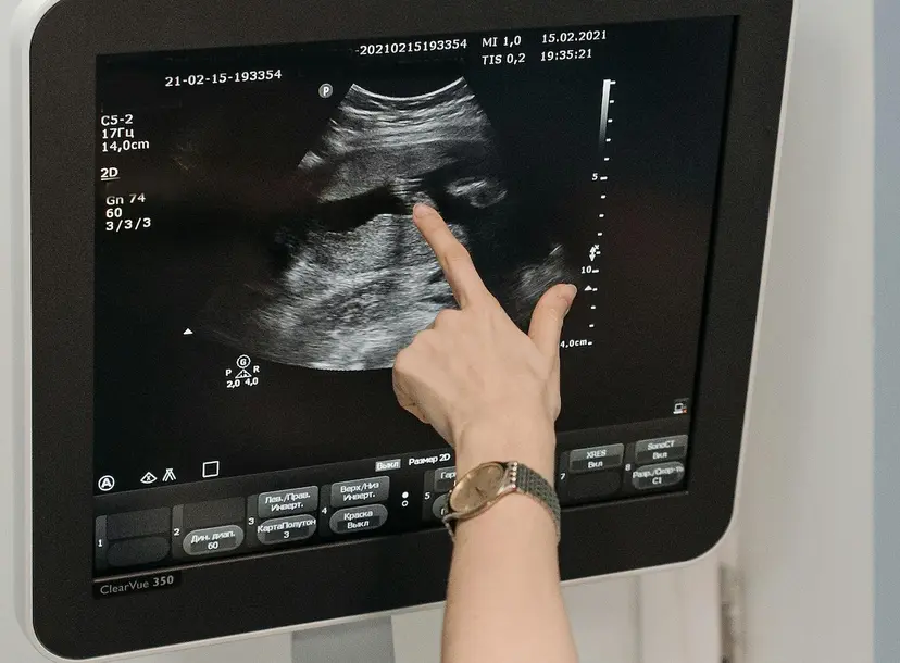 Hand pointing at a sonogram