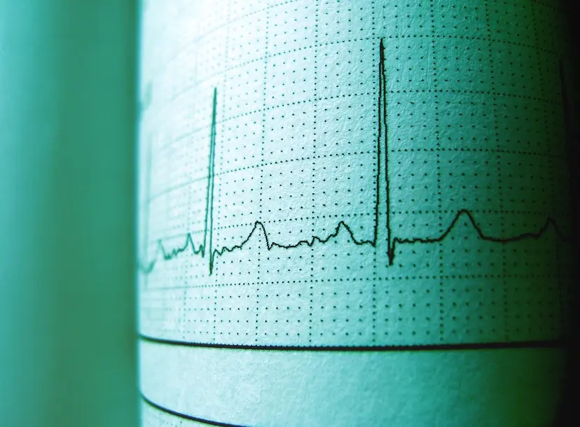 Electrocardiogram