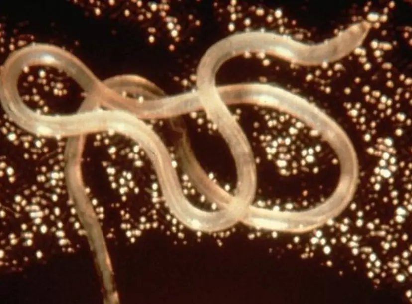 A tapeworm 