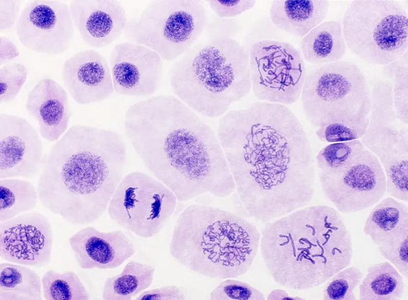 Onion cells stained to show DNA as cells are undergoing mitosis