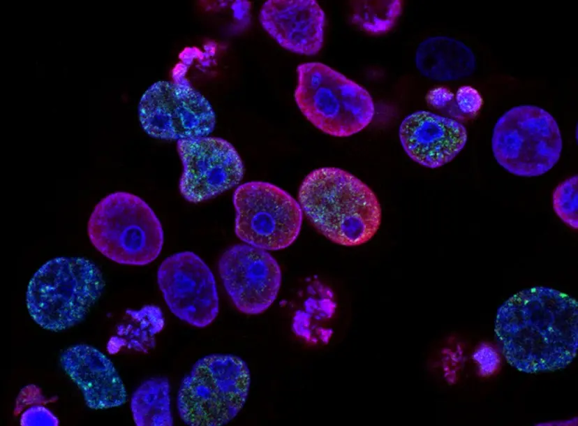 national cancer institute via Unsplash