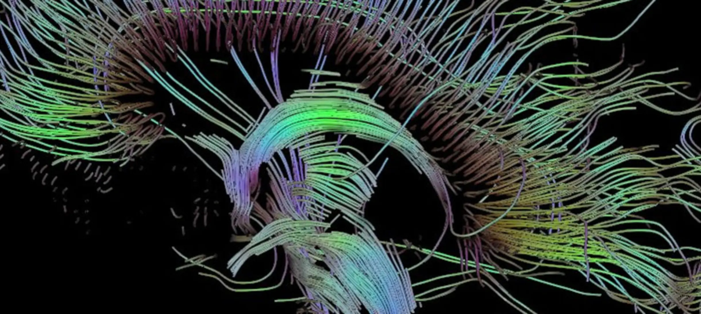 
An image of neural pathways in the brain taken using diffusion tensor imaging, developed at the University of Utah.
