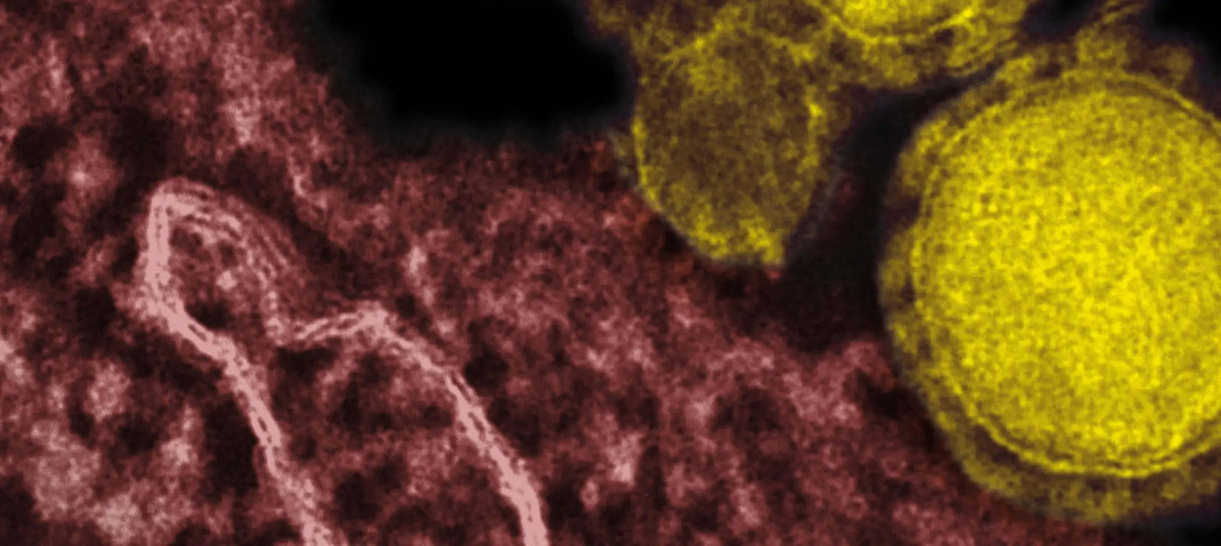 Merscov particles. 