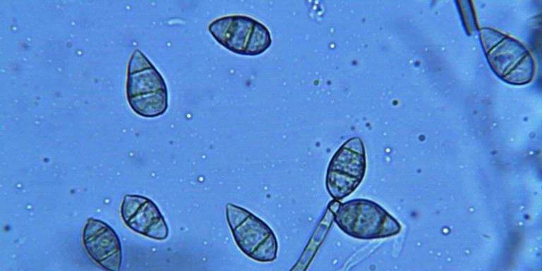 Tiny, egg-shaped rice blast spores