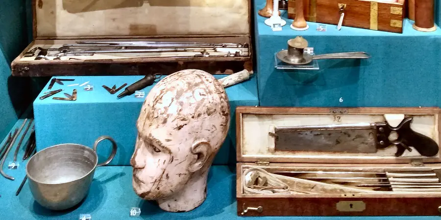 Display at the museum at St Batholomew's Hospital, showing a model of a head next to various historical surgical instruments, including a saw