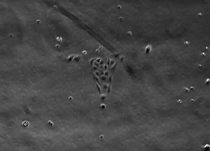 Cells in culture growing in the shape of a uterus