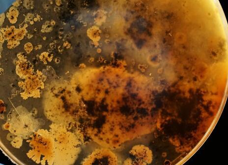 Bacteria in a dish, held in a person wearing a medical glove