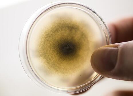 A sample of rice blast fungus in a Petri dish. It's circular, more concentrated in the centre.
