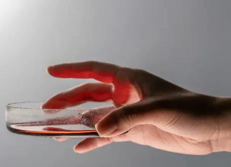 A hand holds a petri dish full of blood