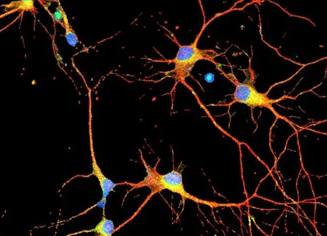 Neurons in the brain