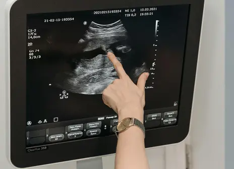 Hand pointing at a sonogram