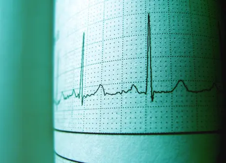 Electrocardiogram