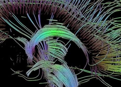 An image of neural pathways in the brain taken using diffusion tensor imaging, developed at the University of Utah.