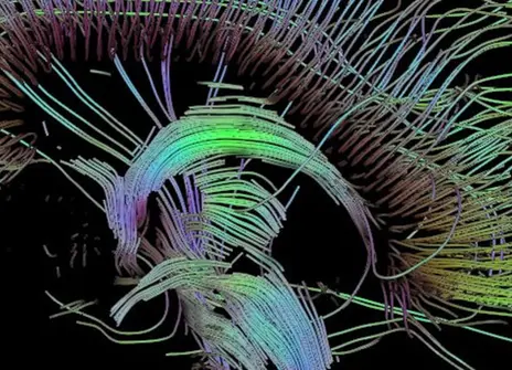 An image of neural pathways in the brain taken using diffusion tensor imaging, developed at the University of Utah.