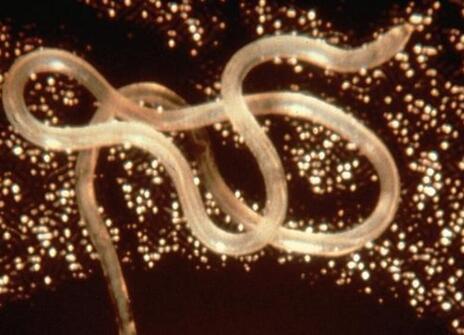 A tapeworm 