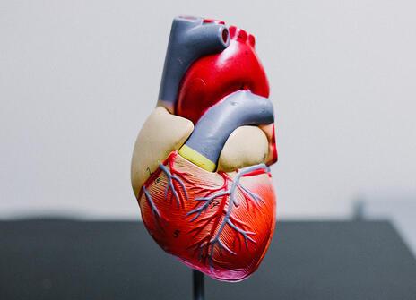 A model of an anatomical heart