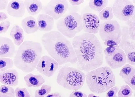 Onion cells stained to show DNA as cells are undergoing mitosis