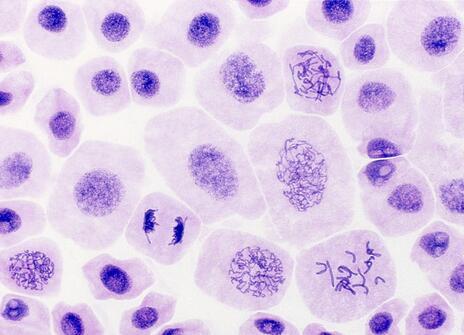 Onion cells stained to show DNA as cells are undergoing mitosis