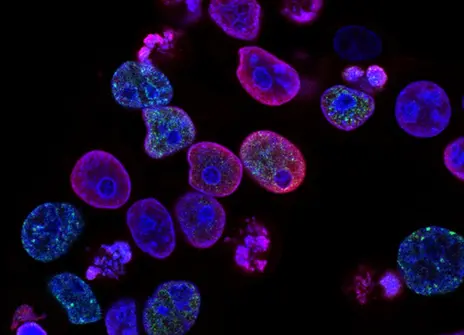 national cancer institute via Unsplash