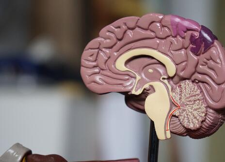 Brain 