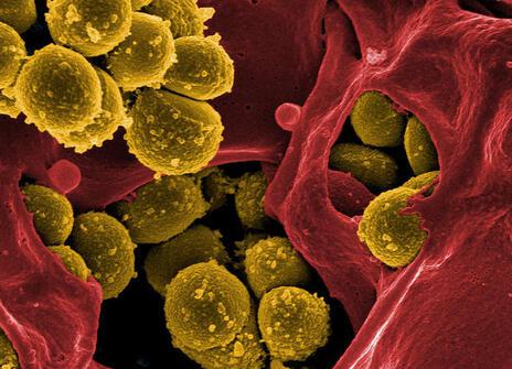 Scanning electron micrograph of methicillin-resistant Staphylococcus aureus and a dead human neutrophil. 